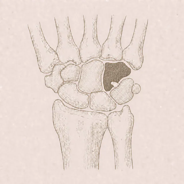 Engraved plate of the hamate, the hooked wrist bone
